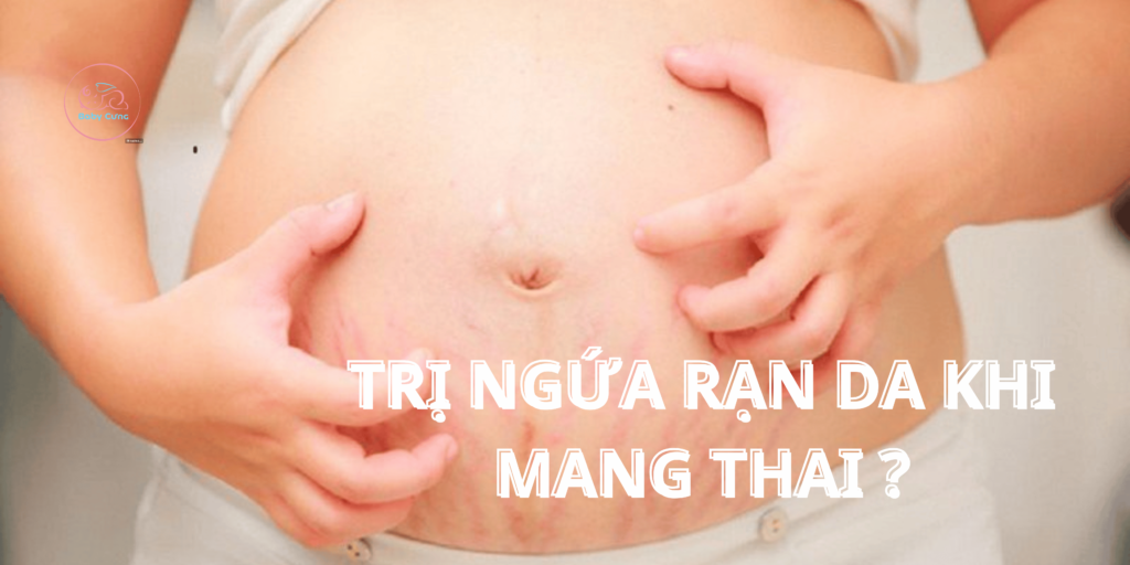 cách trị ngứa rạn da khi mang thai