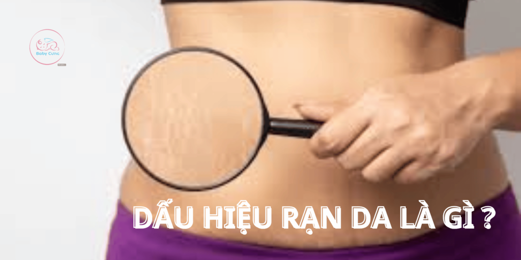 Dấu Hiệu Rạn Da Khi Mang Thai