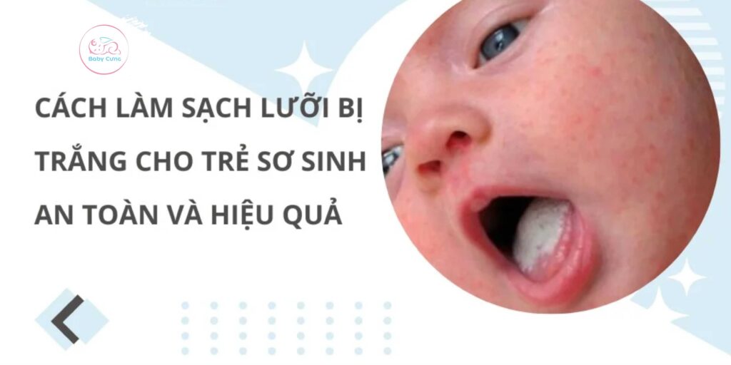 Cách Làm Sạch Lưỡi Bị Trắng Cho Trẻ Sơ Sinh