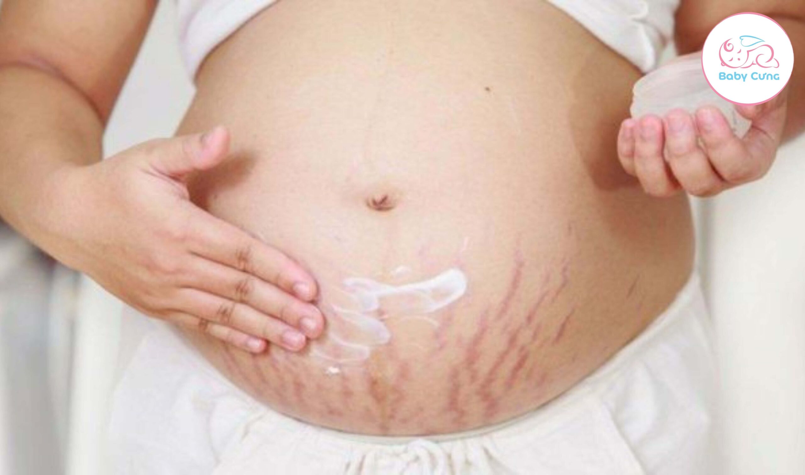 cách trị ngứa rạn da khi mang thai
